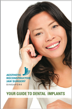 Dental implants in Singapore Dental implants in Singapore