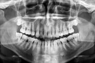 bigstock-Dental-Scan-6247424