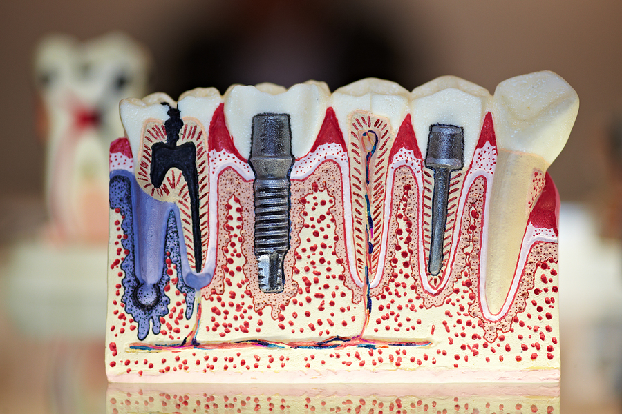 bigstock-COLOGNE--MARCH---New-tooth--27434348