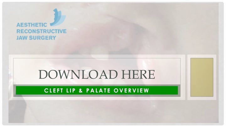 CTA_cleft