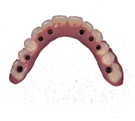 NG7.png