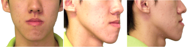 long_face.png