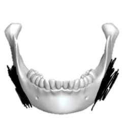 mandible_2.png
