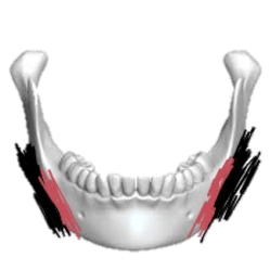 Jaw Reduction & Contouring Surgery