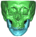 overbite.png