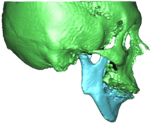 overbite_1.png