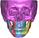 overbite_2.png