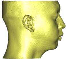 overbite_5.png