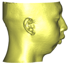 overbite_7.png
