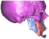 overbite_9.png
