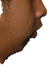 overbite_photo-1.png