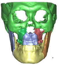 underbite.png