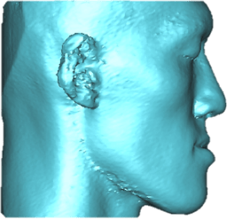 underbite_4.png