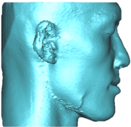 underbite_5.png